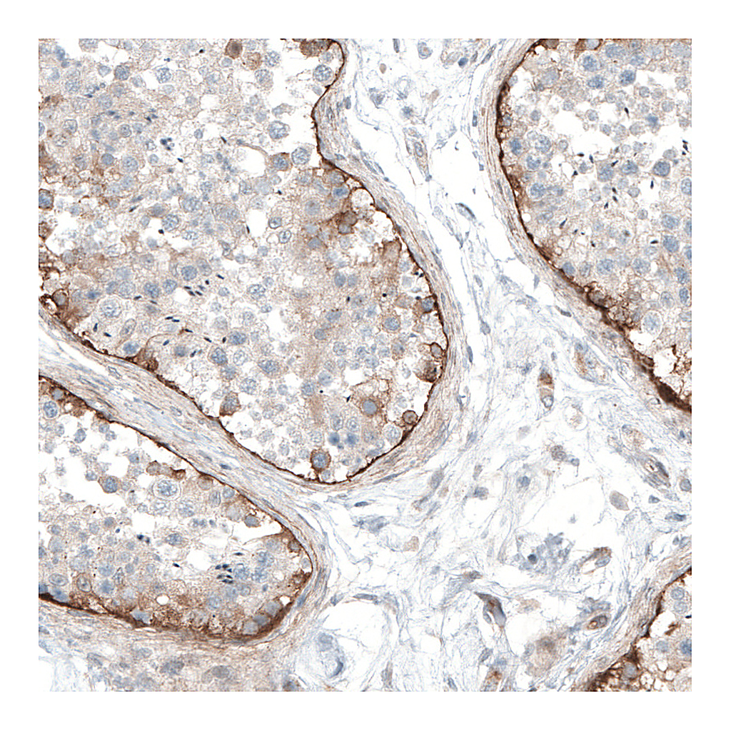 Atlas Antibodies Anti-LAMA1 Antibody