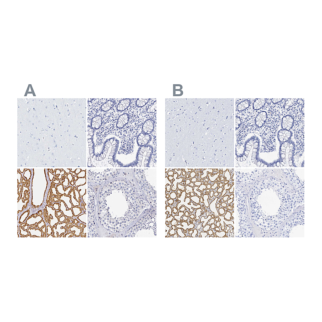 Atlas Antibodies Anti-LALBA Antibody