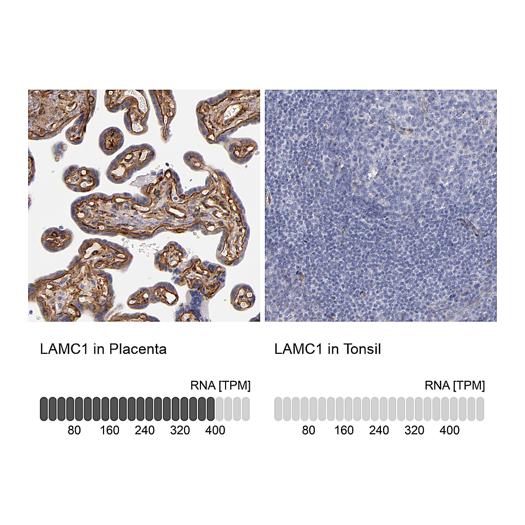Atlas Antibodies Anti-LAMC1 Antibody