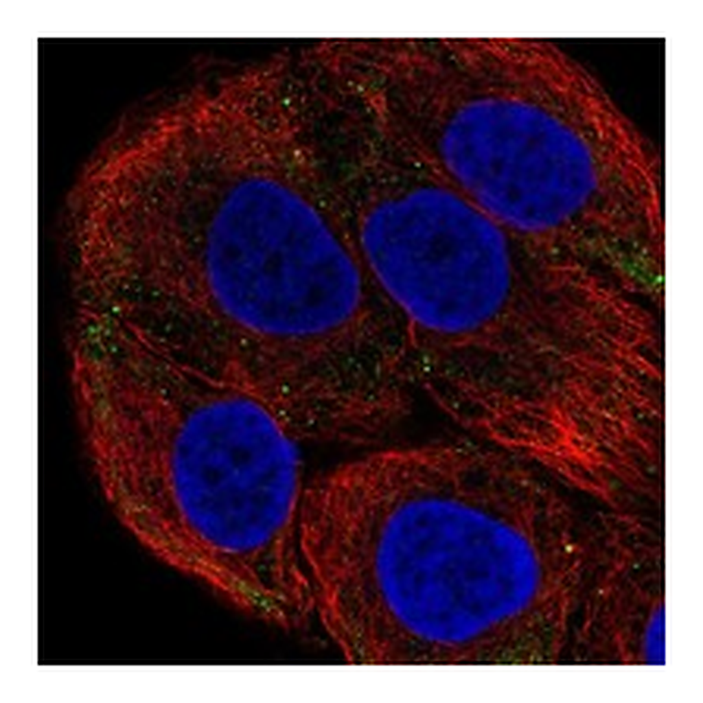 Atlas Antibodies Anti-LAMB3 Antibody