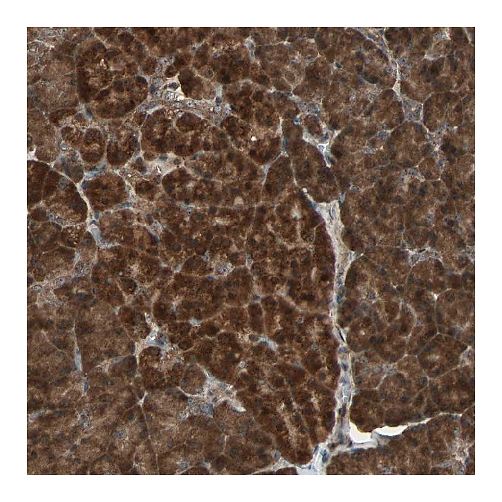 Atlas Antibodies Anti-LAMTOR5 Antibody