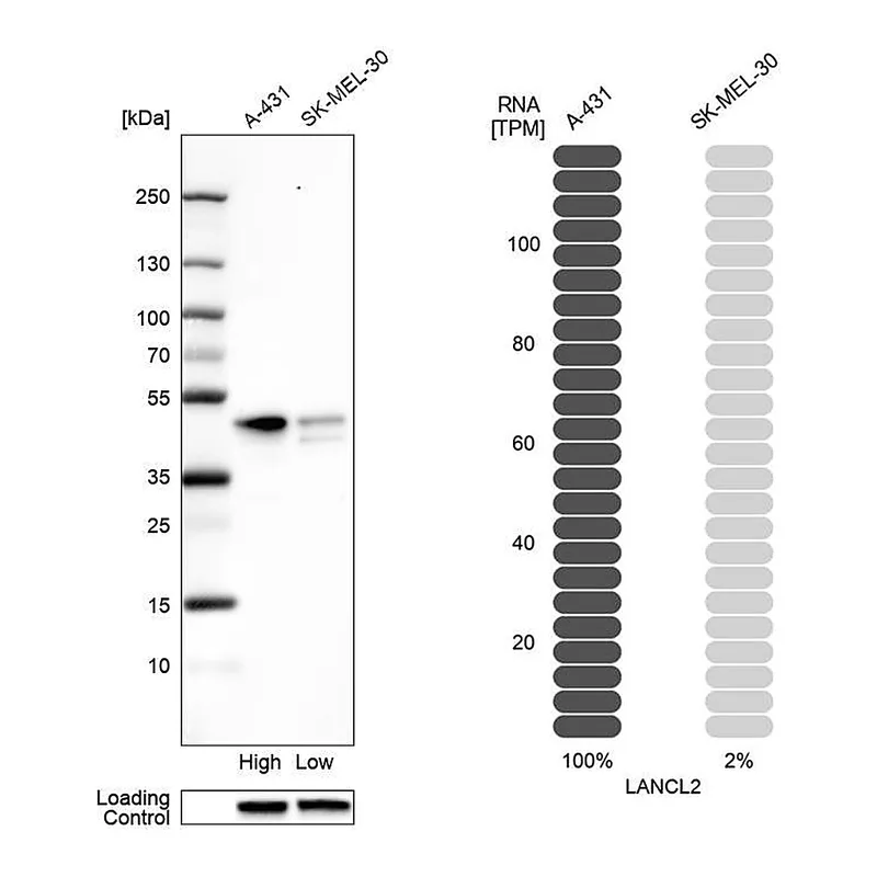 Atlas Antibodies Anti-LANCL2 Antibody