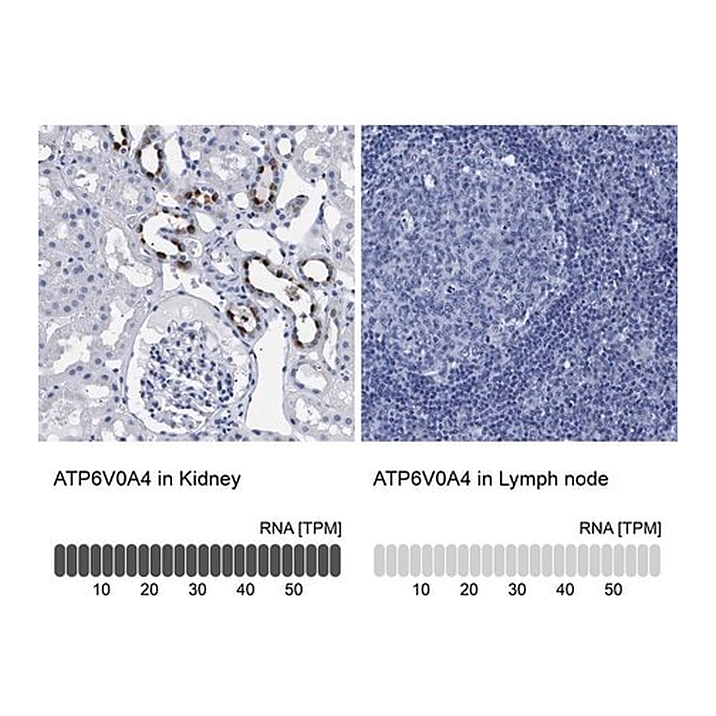 Merck Anti-ATP6V0A4 antibody produced in rabbit