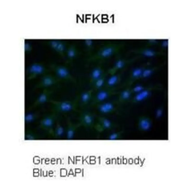 Merck Anti-NFKB1