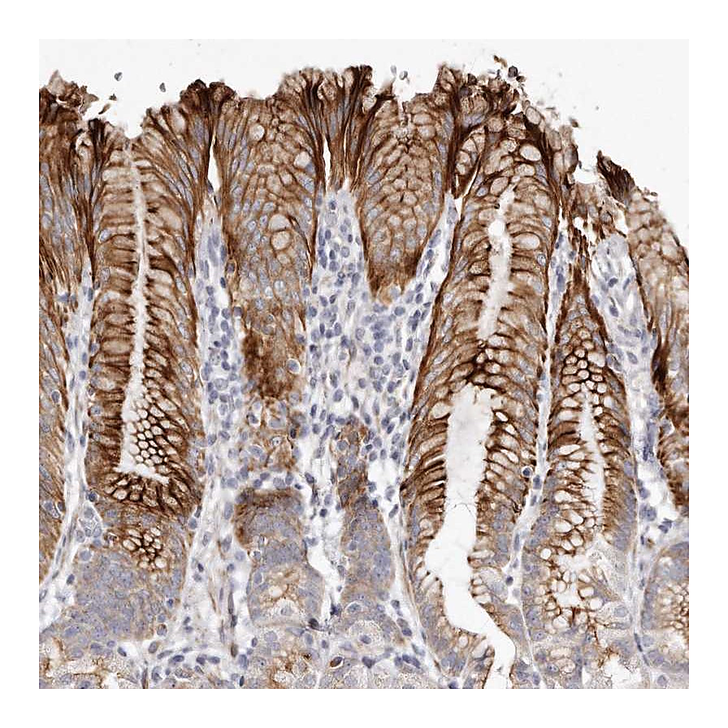 Atlas Antibodies Anti-ZYG11A Antibody