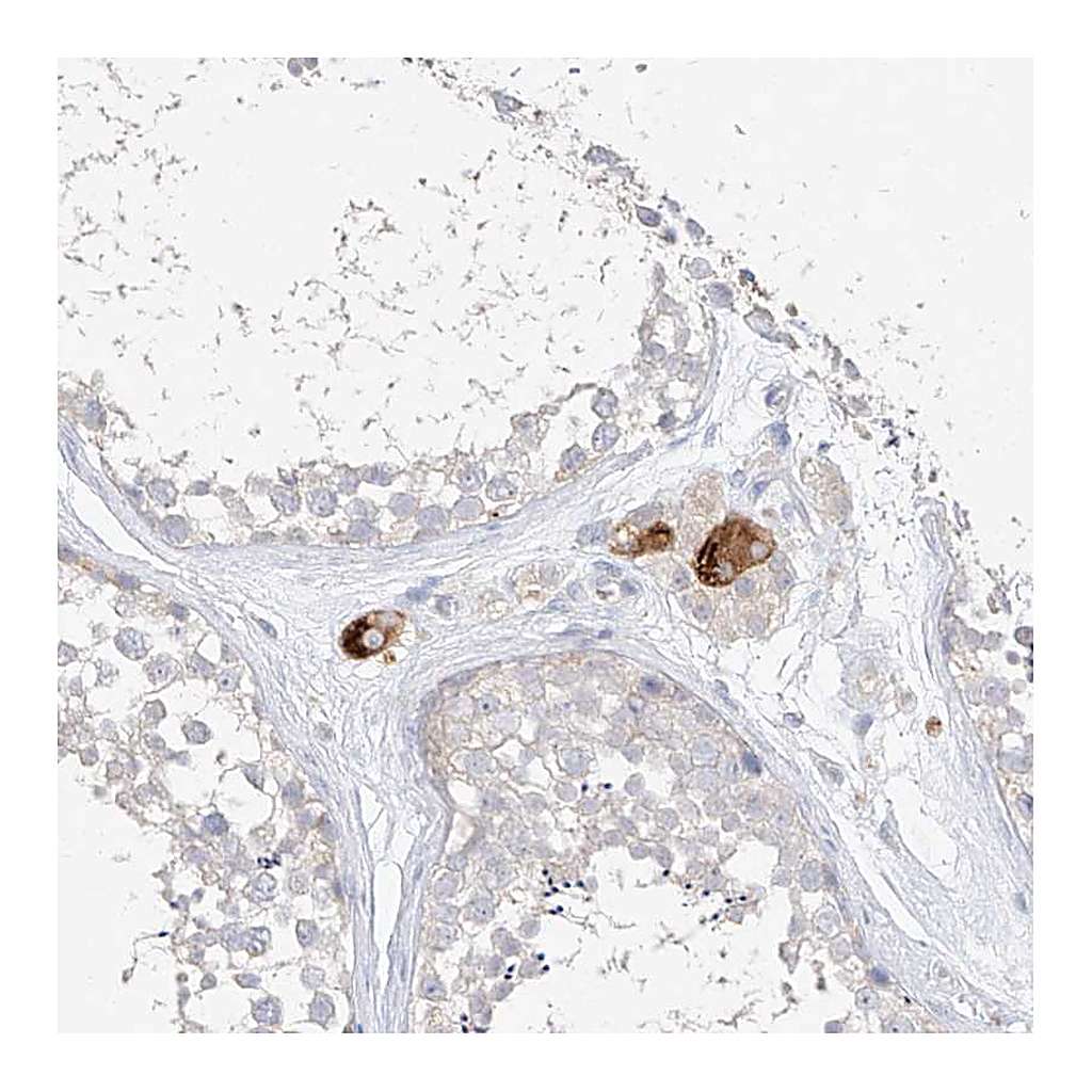 Atlas Antibodies Anti-ZZEF1 Antibody