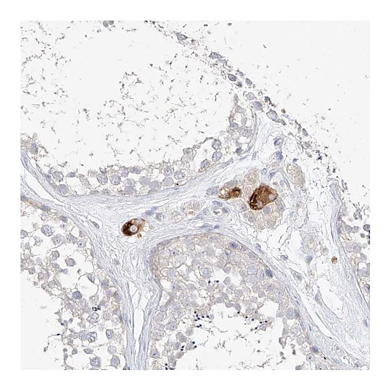 Atlas Antibodies Anti-ZZEF1 Antibody