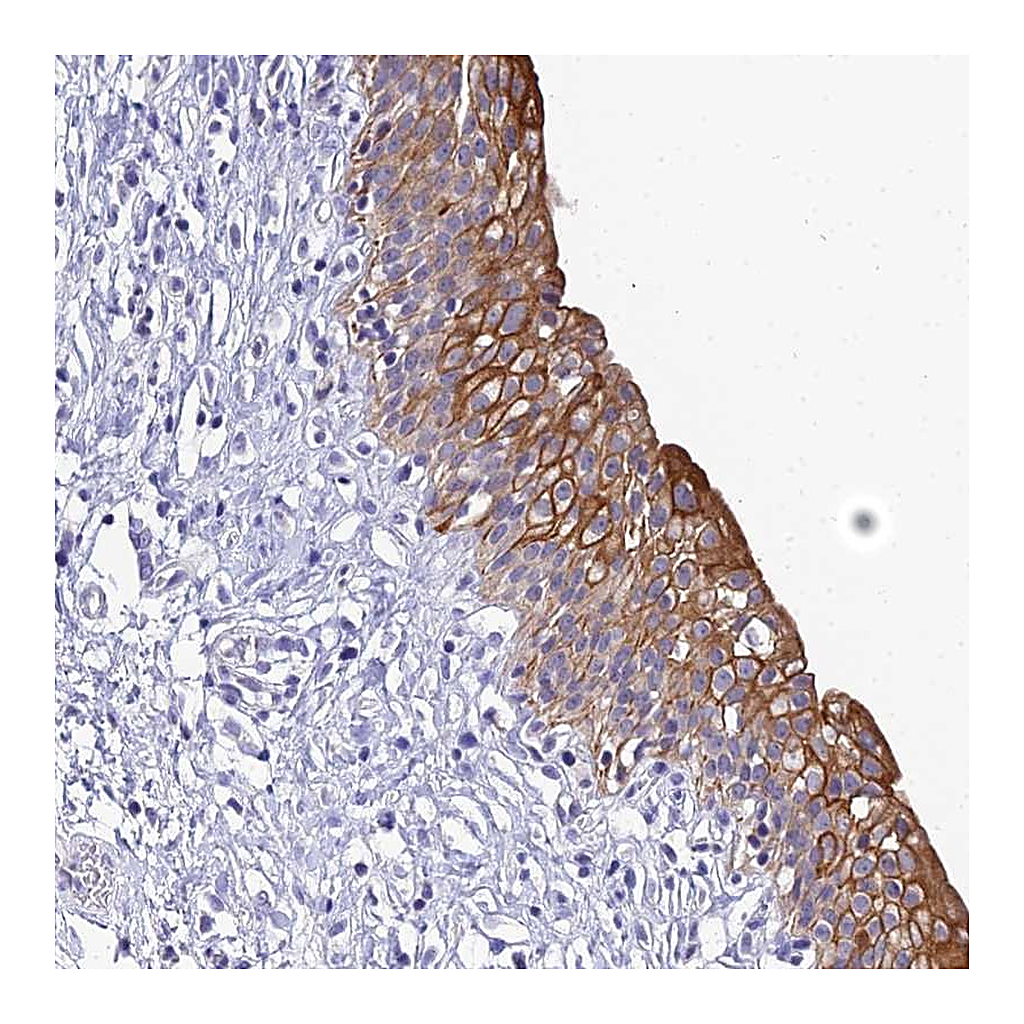 Atlas Antibodies Anti-ZXDB Antibody