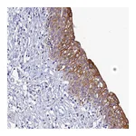 Atlas Antibodies Anti-ZXDB Antibody