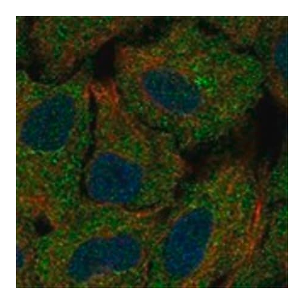 Merck Anti-CSGALNACT1 antibody produced in rabbit