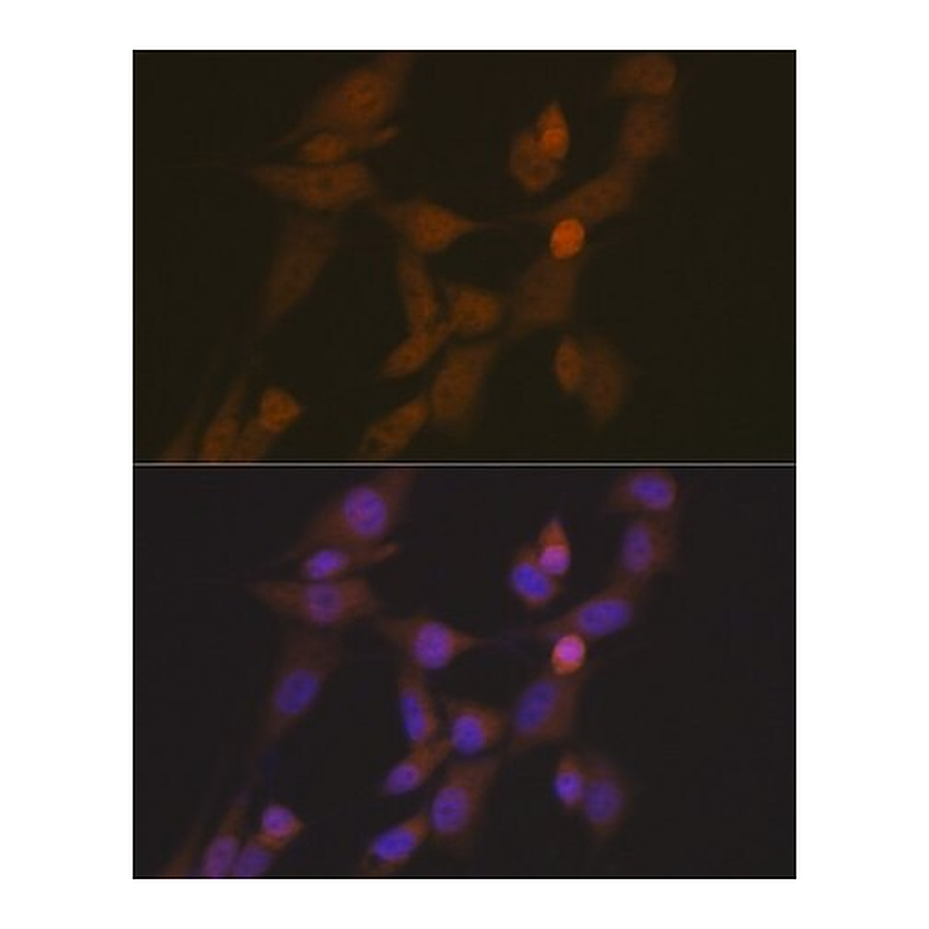 Merck Anti-STK33 antibody produced in rabbit