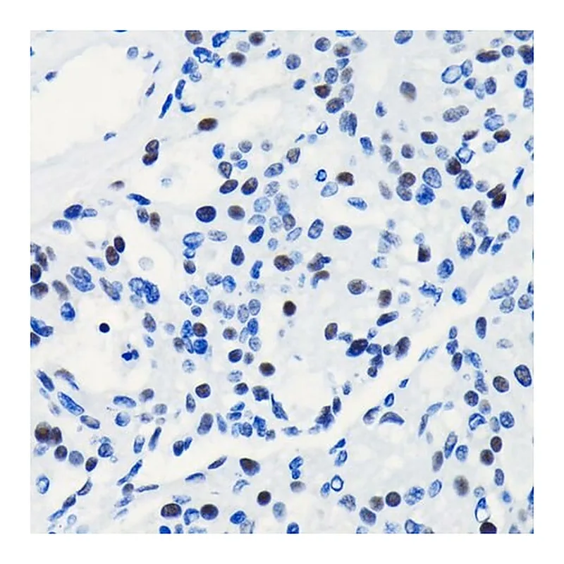 Merck Anti-BRG1/SMARCA4 antibody produced in rabbit