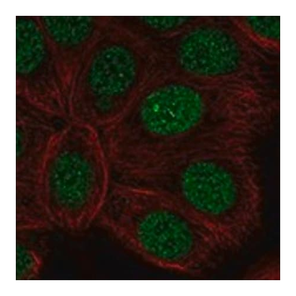 Merck Anti-RARA antibody produced in rabbit