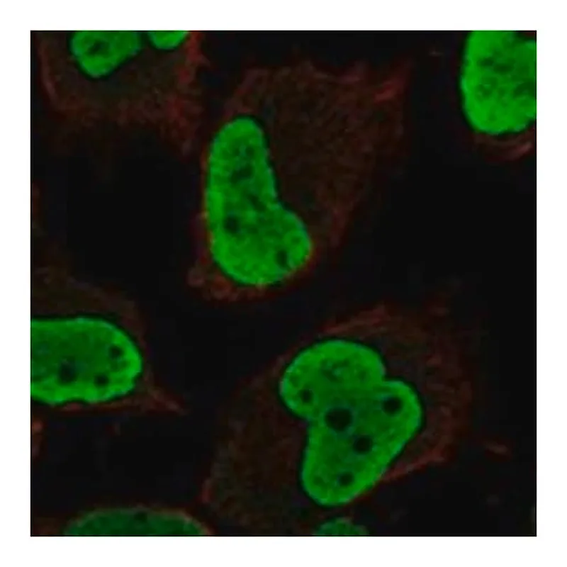 Merck Anti-HMGN5 antibody produced in rabbit