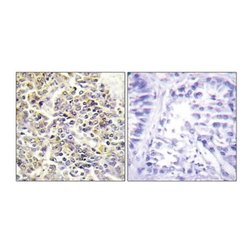 Merck ANTI-ASC ANTIBODY PRODUCED IN RABBIT