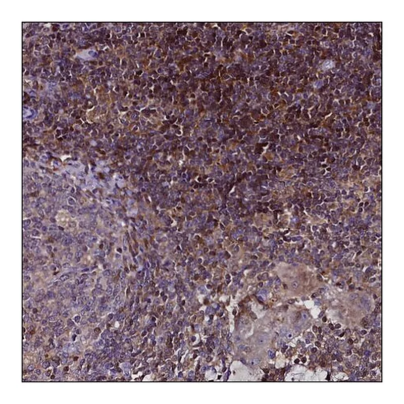 Merck ANTI-AC112512.1