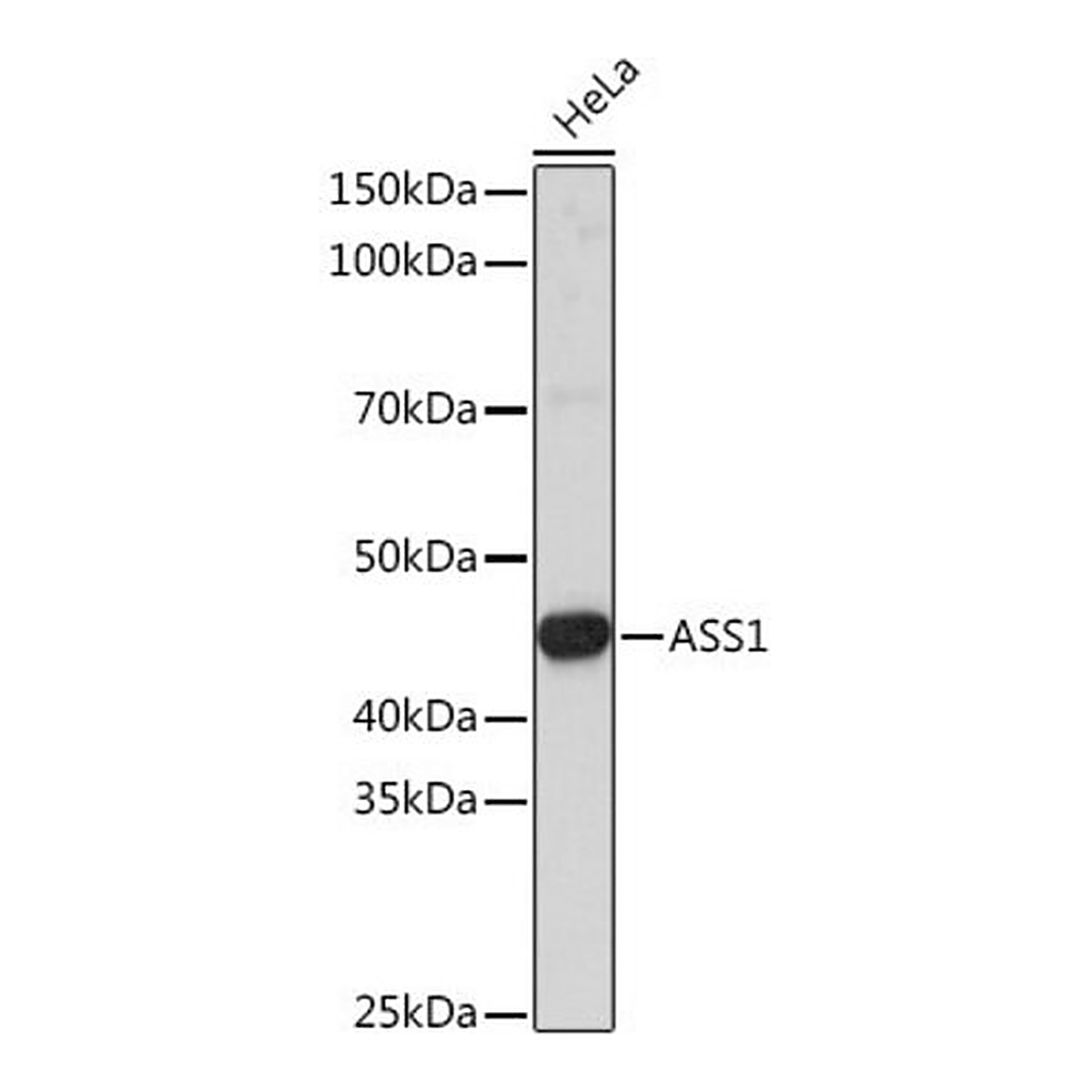 Merck Anti- ASS1 antibody produced in rabbit