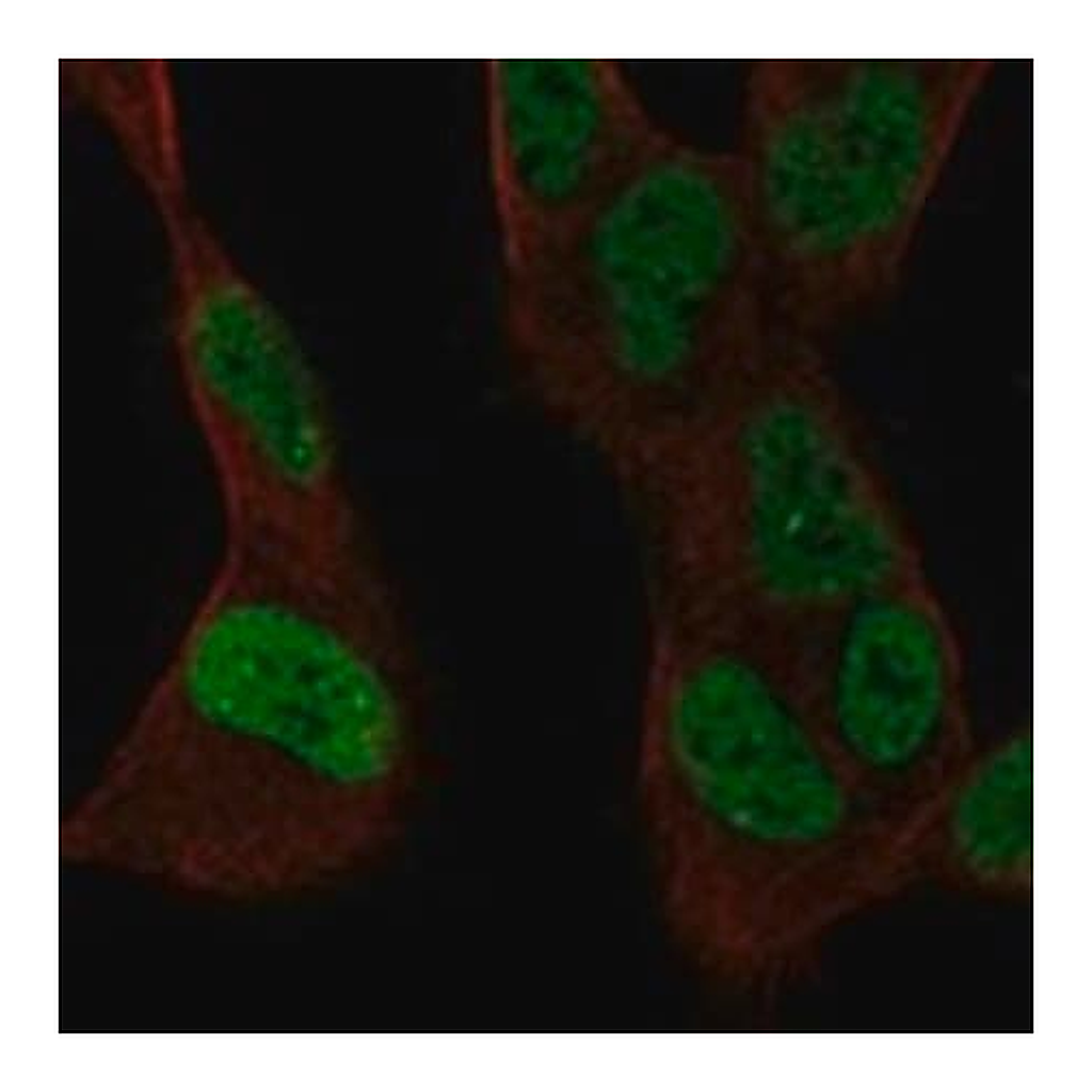 Merck Anti-SSBP2 antibody produced in rabbit