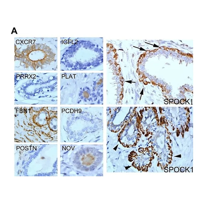 Merck Anti-ACKR3 antibody produced in rabbit