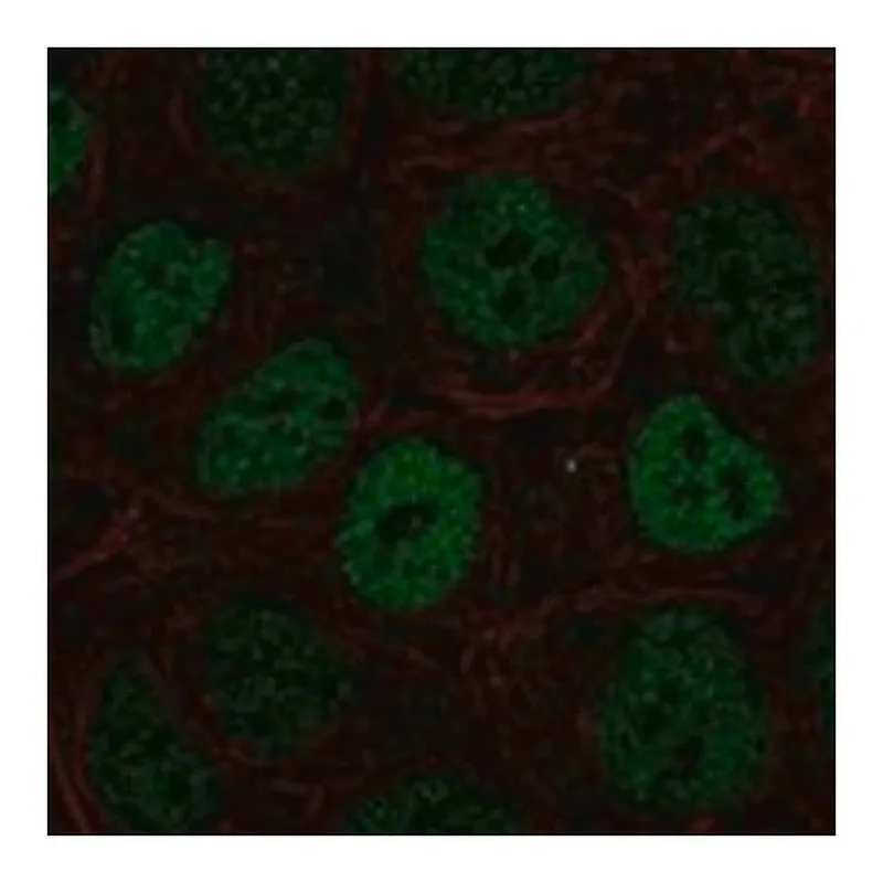 Merck Anti-S100P antibody produced in rabbit