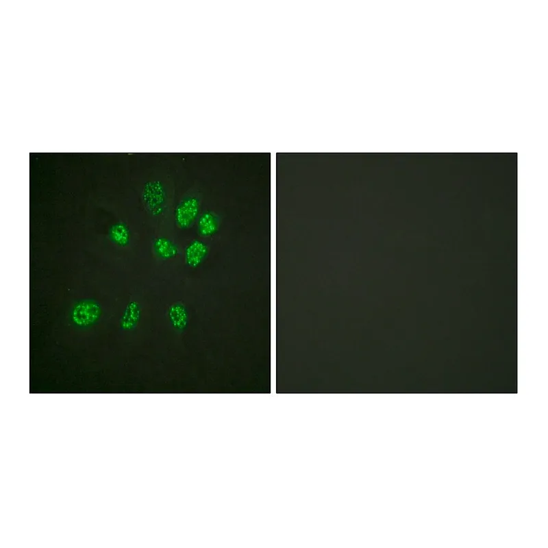 Merck Anti-Estrogen Receptor-beta antibody produced in rabbit