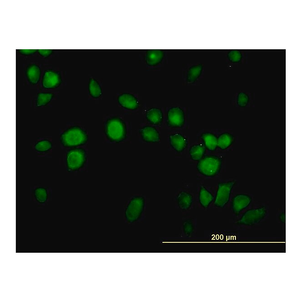 Merck Monoclonal Anti-USP14 antibody produced in mouse