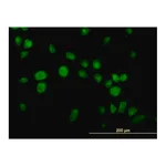 Merck Monoclonal Anti-USP14 antibody produced in mouse