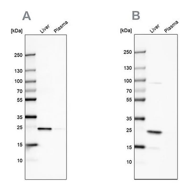 Merck Anti-CRP antibody produced in rabbit