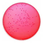 Himedia Xylose Lysine Deoxycholate Agar (XLD Agar)