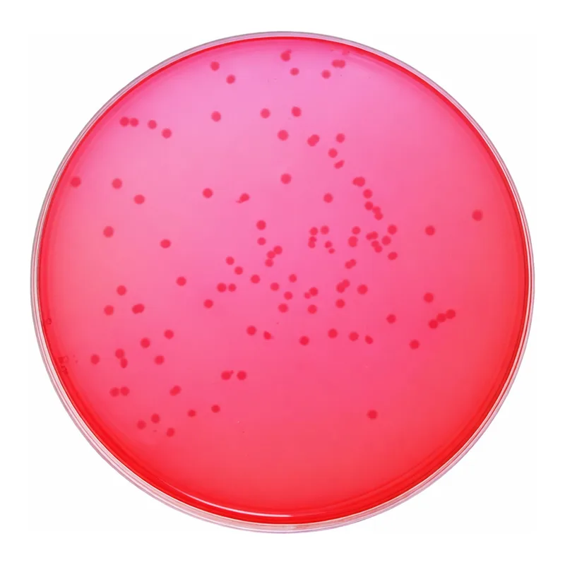 Himedia Xylose Lysine Deoxycholate Agar (XLD Agar)