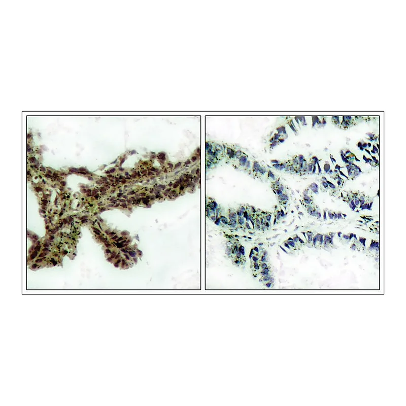 Merck Anti-phospho-AKT1 (pThr308) antibody produced in rabbit