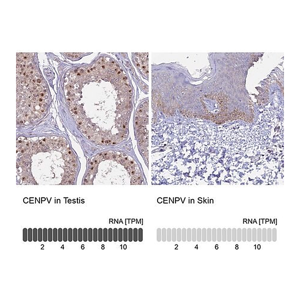 Merck Anti-CENPV antibody produced in rabbit