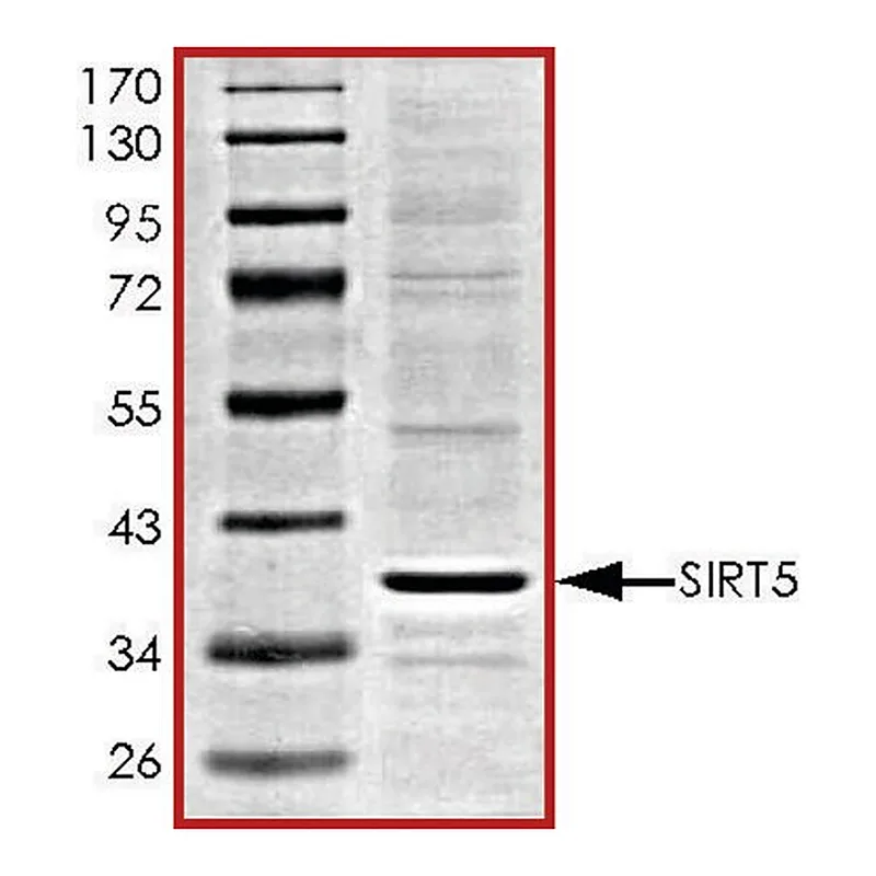 Merck SIRT5, active, His tagged human