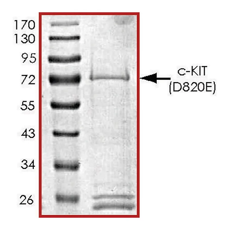 Merck c-KIT (D820E), active, GST tagged human