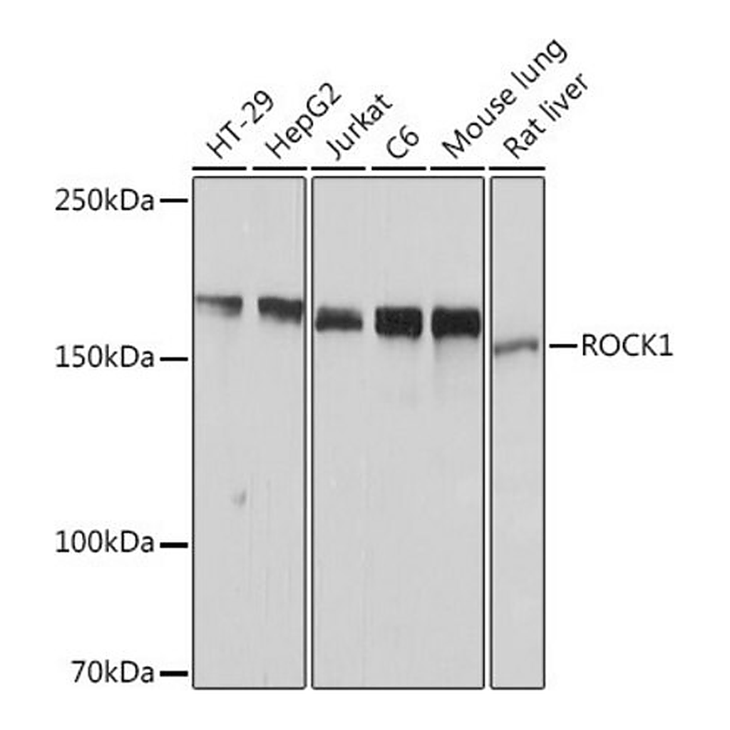 Merck Anti-ROCK1 antibody produced in rabbit