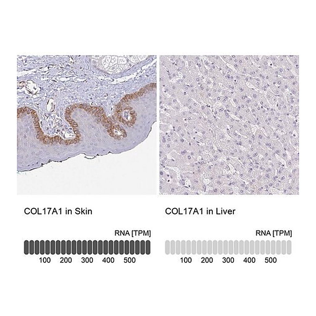 Merck Anti-COL17A1 antibody produced in rabbit