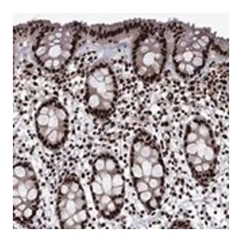 Merck Anti-LIMK1 antibody produced in rabbit