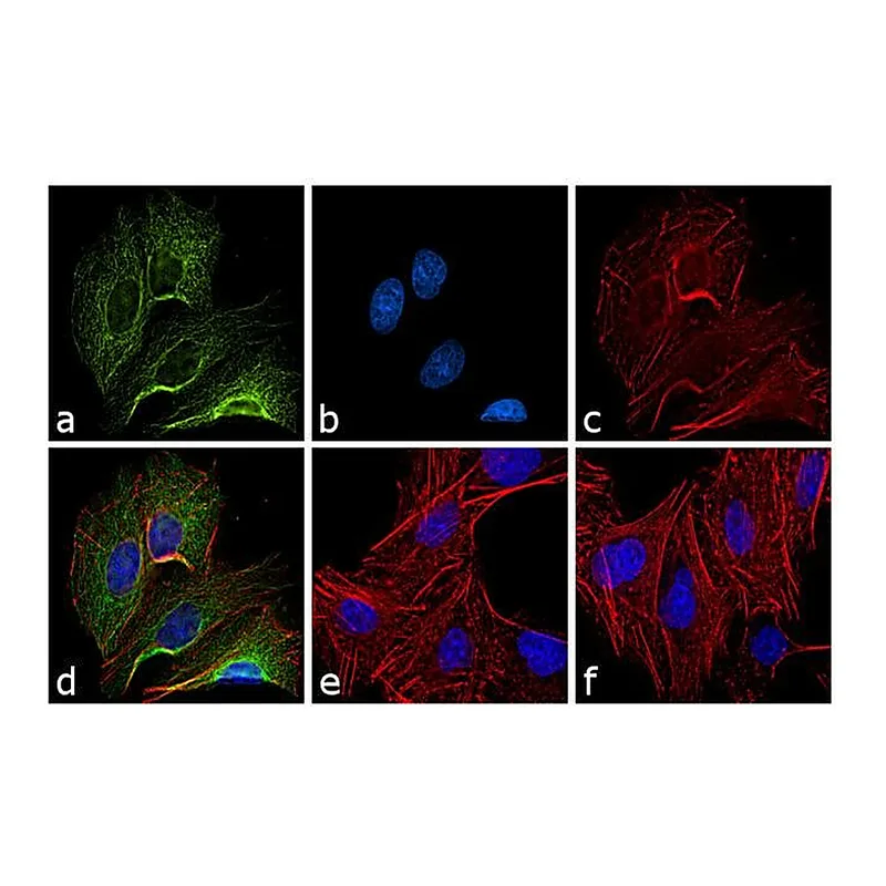 Thermo Fisher Scientific Donkey anti-Rat IgG (H+L) Cross-Adsorbed Secondary Antibody, DyLight 488