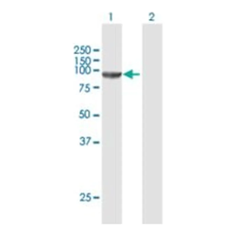 Merck ANTI-CSDE1