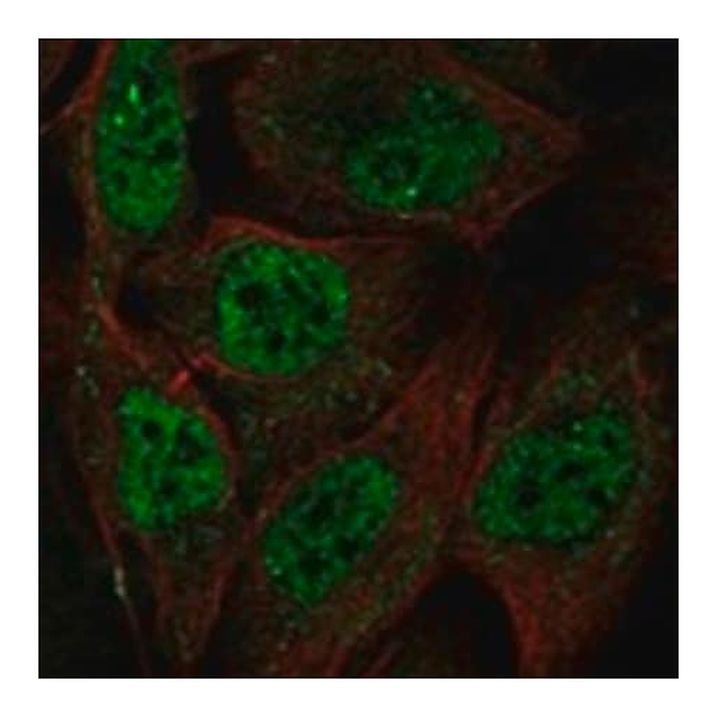 Merck Anti-MCM8 antibody produced in rabbit