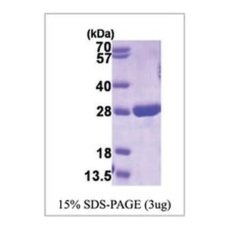 Merck GSTP1, HUMAN