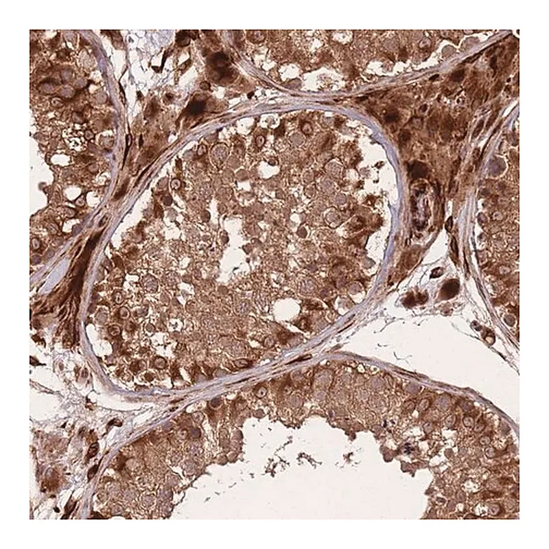 Merck Anti-ERBB3 antibody produced in rabbit