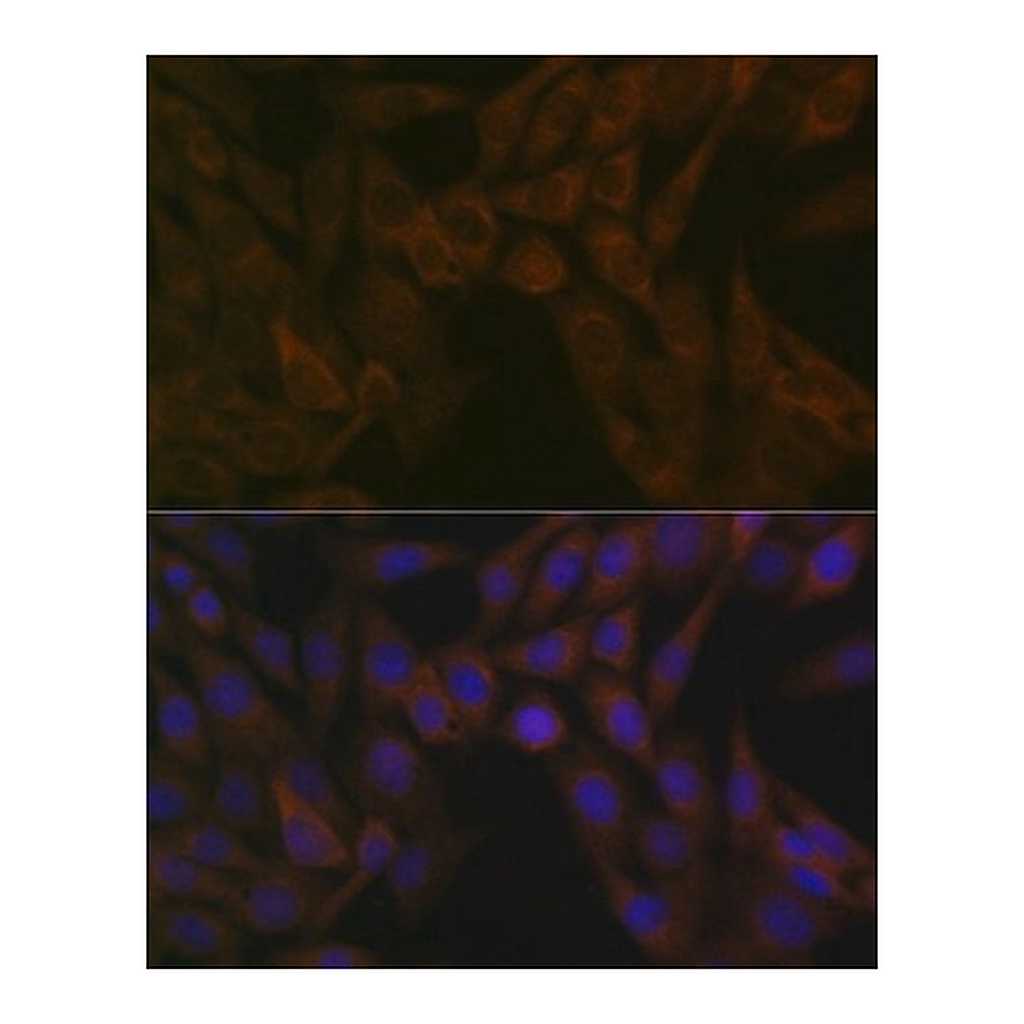 Merck Anti-ARF5 antibody produced in rabbit