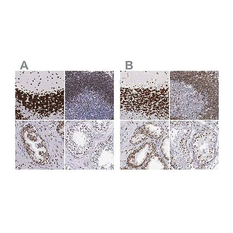 Merck Anti-MECP2 antibody produced in rabbit