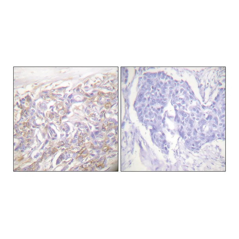 Merck Anti-TNF Receptor I antibody produced in rabbit