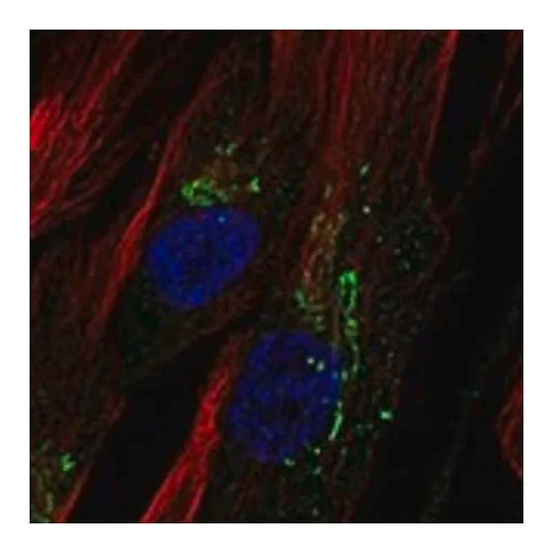 Merck Anti-CHI3L1 antibody produced in rabbit