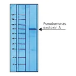 Merck PSEUDOMONAS EXOTOXIN A FROM PSEUDOMONAS