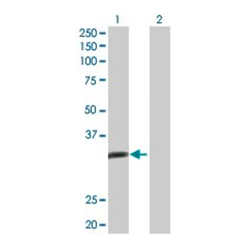 Merck Anti-ALKBH3 antibody produced in rabbit