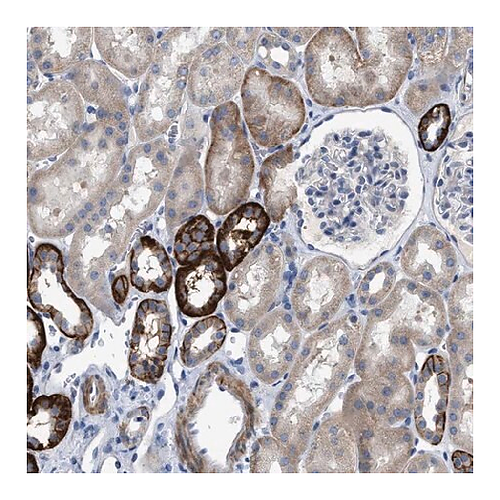 Merck Anti-DHX58 antibody produced in rabbit