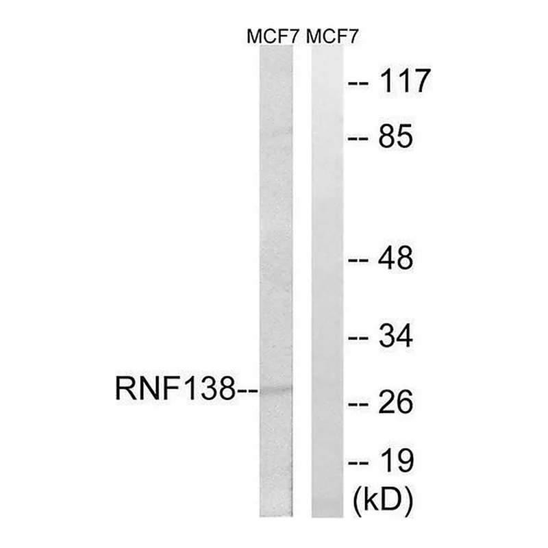 Merck Anti-RNF138 antibody produced in rabbit